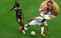 Ngôi sao Canada gãy chân kinh hoàng ở World Cup lên tiếng sau ca phẫu thuật