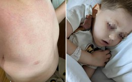 Nam shipper 38 tuổi bật khóc: "Bác sĩ nói vết ngứa trên da con tôi không đáng lo, 3 tuần sau lại bảo là ung thư"