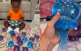 Cảnh báo về món đồ chơi hot Tiktok hàng triệu người đang mua: Con chỉ làm theo một video trên mạng, hậu quả là bỏng mặt và cánh tay