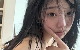 Ung thư vòm họng rất "xảo quyệt": 4 tín hiệu cầu cứu sớm nhưng dễ bị nhầm thành ốm vặt