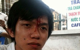 Cty Thiên Ngọc Minh Uy hứa khắc phục vụ việc 'đánh hội đồng khiến sinh viên chảy máu đầu'