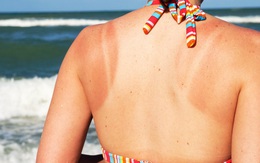 Sắm ngay một trong những tuýp kem chống nắng dưới đây cho ngày hè nắng rát