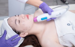 Công nghệ trẻ hóa xóa nhăn hàng đầu Hoa Kỳ Thermage FLX tại Amia Beauty Center