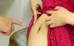 Chuyên gia vạch trần sự thật tàn nhẫn về nạn “thẩm mỹ chui”