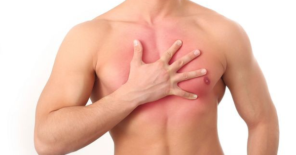 4 triệu chứng ung thư vú không ngờ ở nam giới, căn bệnh tưởng chỉ gặp phải ở các chị em