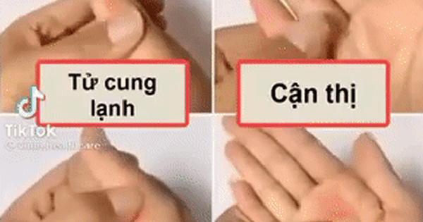 Ngoài huyệt Đại Lăng, còn có những điểm bấm huyệt nào khác có thể giúp trị hôi miệng?
