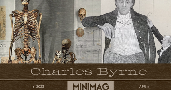 Bộ xương Người khổng lồ Ireland: Tấn bi kịch gây tranh cãi nhất lịch sử Anh Quốc