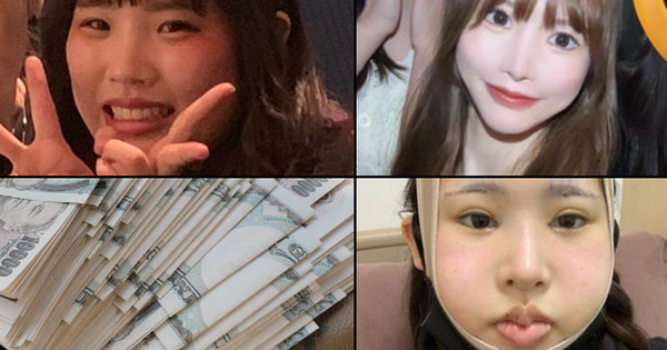 Cô gái chi hơn 3 tỷ để thẩm mỹ, giảm cân vì bị tình cũ chê, kết quả thế nào?