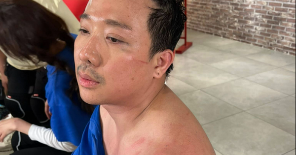 Trấn Thành tiếp tục phải trả giá