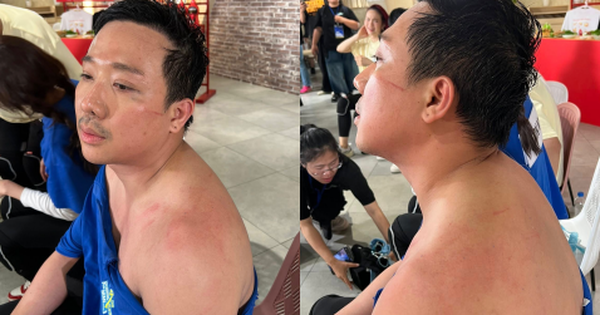 Chưa bao giờ thấy Trấn Thành tơi tả đến mức độ này