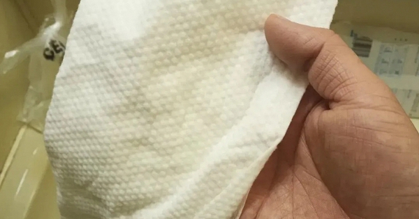 Phát hiện hóa chất độc hại trong 21 mẫu khăn lau mặt bán chạy nhất các sàn thương mại điện tử