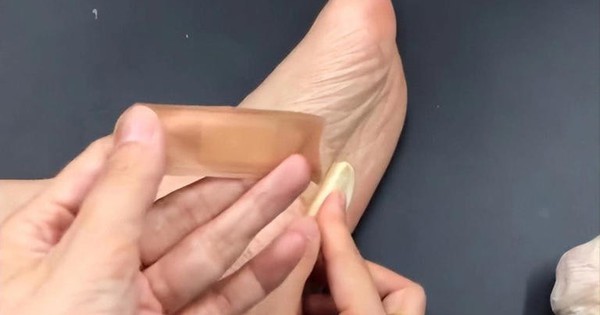 Người phụ nữ 56 tuổi dán tỏi vào lòng bàn chân suốt 6 tháng, kết quả khám sức khỏe khiến bác sĩ "ngã ngửa"