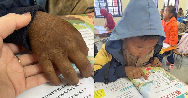 Hình ảnh bàn tay nứt nẻ của cậu bé 8 tuổi vùng cao khiến triệu người nghẹn lại