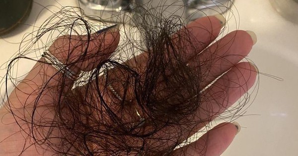 Bạn đang tự đẩy mình vào “thảm cảnh” tóc rụng cả nắm vì gội đầu sai giờ
