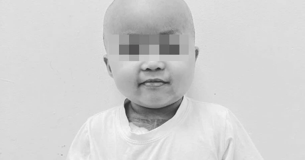 Bé Bắp qua đời