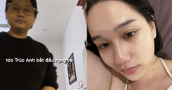 Trúc Anh (Mắt Biếc) công khai hình ảnh lạ lúc tăng cân: Không thể đi nhanh, khóc vì thay đổi gây sốc của cơ thể