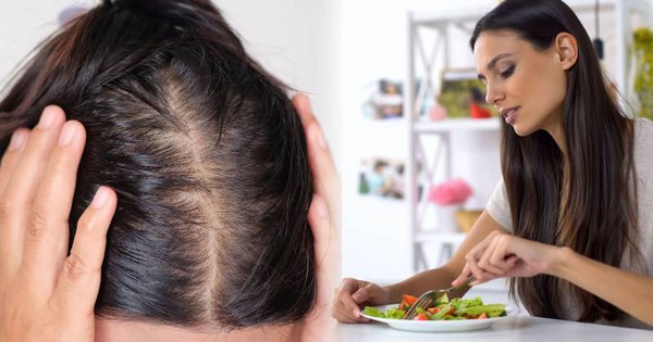 Tóc rụng tơi tả chỉ vì hàng ngày luôn có 2 kiểu ăn, đáng tiếc toàn kiểu chị em rất thích