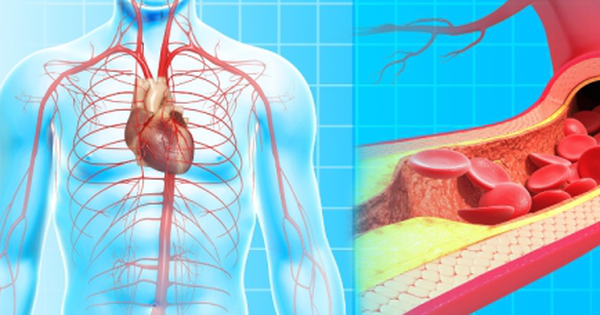 Mạch máu càng trẻ, càng sống lâu: Bác sĩ chỉ cách kiểm tra và làm sạch mạch máu