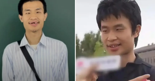 "Thiên tài toán học" Trung Quốc xuất hiện với ngoại hình khác lạ!