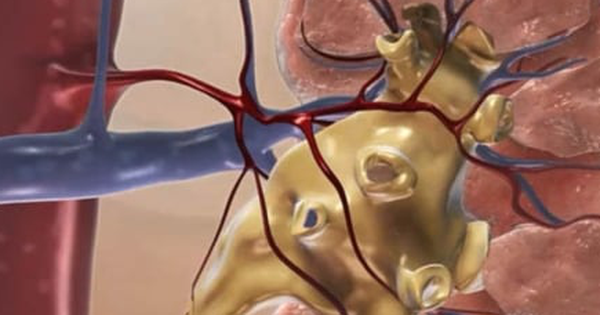 8 dấu hiệu suy thận giai đoạn đầu bạn không nên bỏ qua