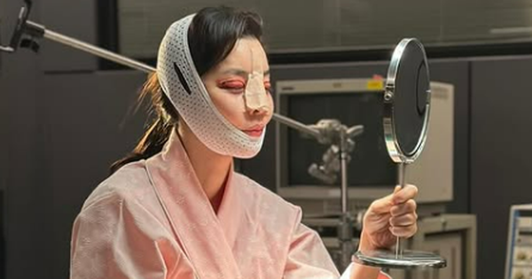 Mỹ nhân Giày Thủy Tinh gây sốc với gương mặt sưng tấy đáng sợ, băng bó kín mít