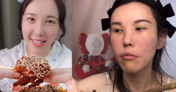 Mặt nữ mukbang biến dạng nghiêm trọng sau 2 năm hành nghề