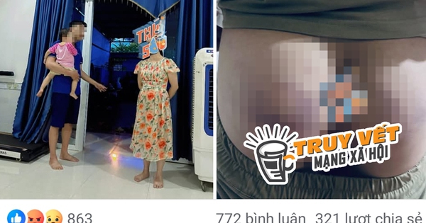 Công an xác minh thông tin cô giáo đánh học sinh bầm tím mông