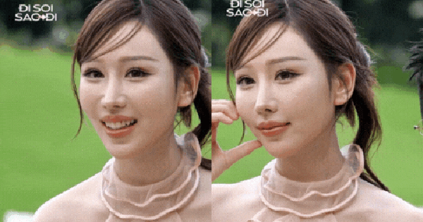 Gương mặt ngày càng đơ cứng của MIN