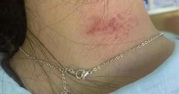 Phát hiện kim loại nặng độc hại vượt mức 1.179 lần cho phép trong loạt trang sức bán chạy nhất trên sàn thương mại điện tử