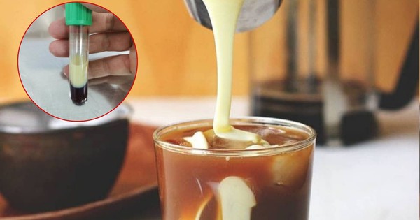 Người gầy, ăn ít dầu mỡ nhưng mỡ máu vẫn cao vút: “Ngã ngửa” khi biết lý do