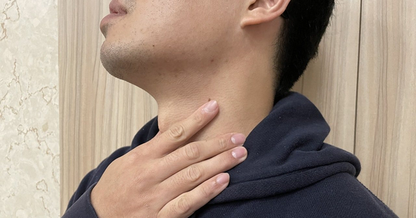 Uống 5 lon nước ngọt mỗi ngày, nam thanh niên trào ngược dạ dày 98 lần