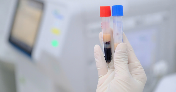 Ăn chay, gầy gò như “xác ve” vẫn sốc vì mỡ máu cao: Bác sĩ chỉ ra "thủ phạm" quen mặt