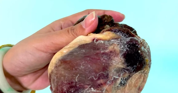 Mổ thịt con bò chỉ ngủ đứng, phát hiện vật thể nghi là ngưu hoàng quý hiếm