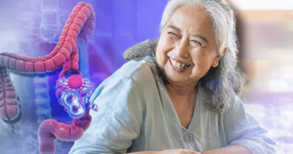 Mẹ chồng tôi bị ung thư trực tràng vì 1 thói quen tiết kiệm tưởng vô hại nhưng 30 năm sau bệnh không tái phát nhờ 3 thay đổi quan trọng