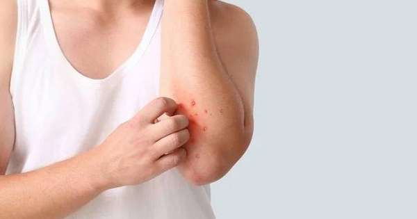 Người đàn ông 40 tuổi phát hiện ung thư gan giai đoạn cuối: Đáng tiếc ông đã bỏ qua dấu hiệu suốt 3 tháng