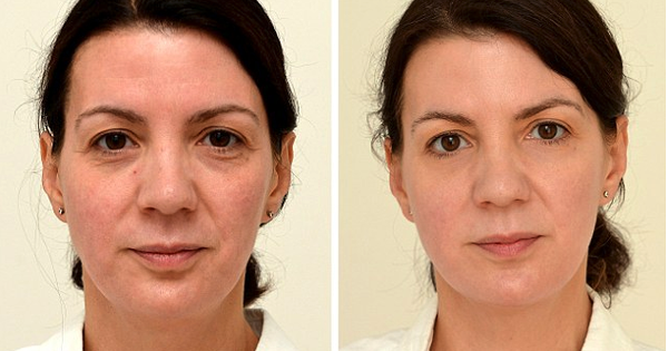 Thử nghiệm uống đủ lượng nước này trong 4 tuần, người phụ nữ 4x trẻ ra 10 tuổi