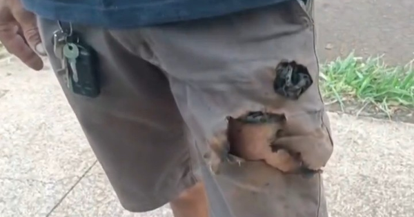 Điện thoại phát nổ cứu sống một người khỏi nanh vuốt chó dữ