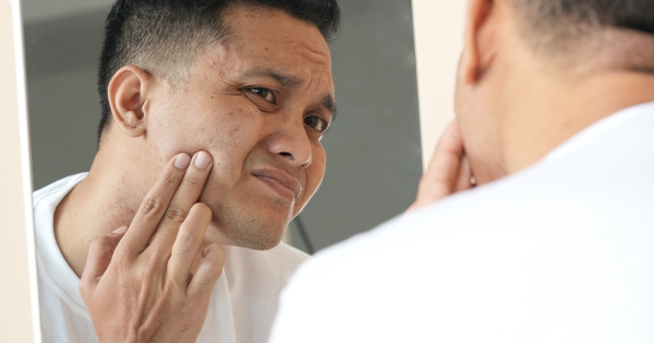 Triệu chứng ban đầu của bệnh tiểu đường có thể xuất hiện trên mặt: Thấy 7 dấu hiệu này, hãy đi khám ngay