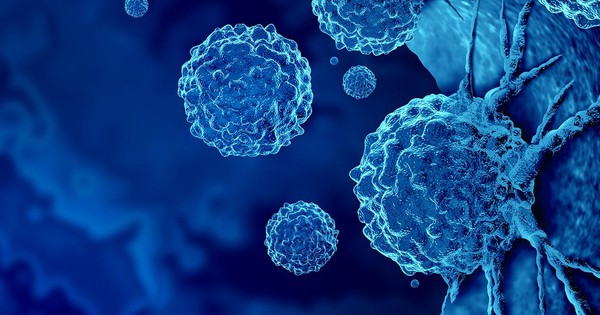 Loại ung thư đứng thứ 2 về tỉ lệ tử vong tại Việt Nam: 5 dấu hiệu sớm nhất ai cũng nên biết