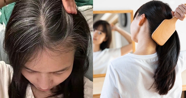 Nhiều người chưa 30 tuổi đã bạc tóc: 3 nhóm người dễ có tóc bạc nhất và 3 cách đơn giản giúp tóc đen lâu hơn