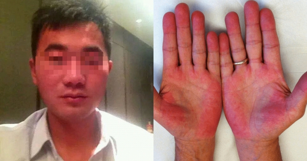 Người đàn ông không bia rượu nhưng ngày nào cũng bị kiểm tra nồng độ cồn, biết sự thật phía sau ai cũng xót xa