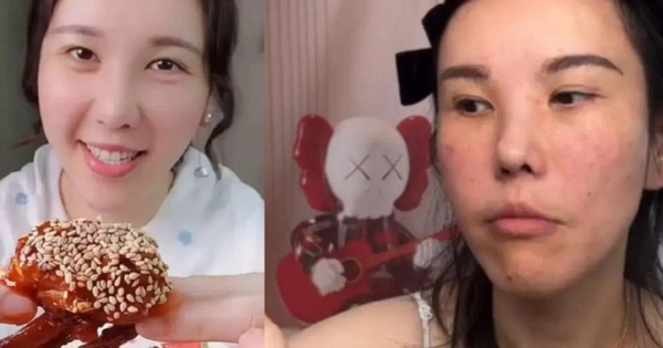 Mặt cô gái trẻ biến dạng sau 2 năm làm mukbang, bác sĩ cảnh báo 4 cái giá phải trả về sức khỏe ít ai biết đến