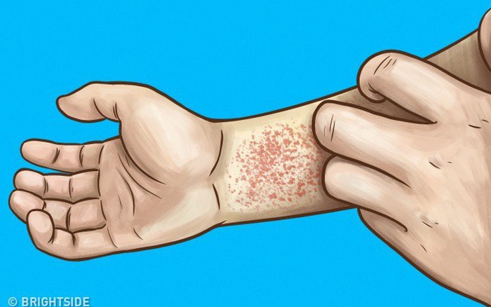 10 dấu hiệu cảnh báo thận của bạn bị 'ốm' và làm việc không ...