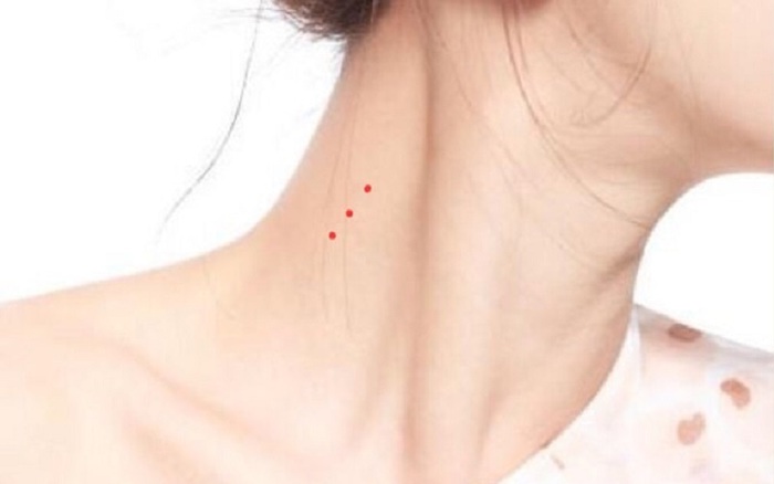 Nốt ruồi son ở cổ