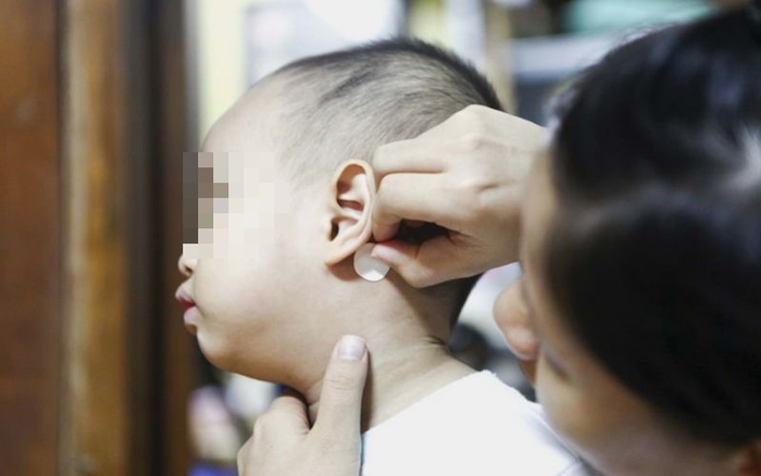 Bé 7 tuổi ở TP.HCM bị rối loạn tâm thần cấp tính: Bác sĩ phát hiện thủ phạm  đến từ miếng dán chống say tàu xe